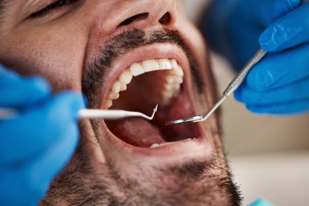Best Emergency Dentist Near Me  in Prichard, AL