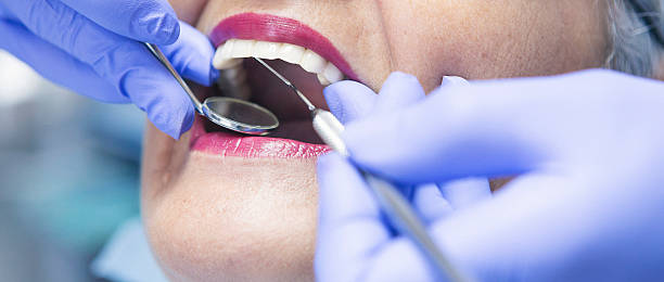 Best Knocked-Out Tooth Emergency  in Prichard, AL